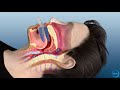 Flextap oral appliance for sleep apnea how does it work