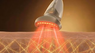 Hot Cool Neck Beauty Device Ro