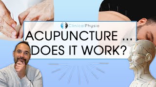 Does Acupuncture Work in Physiotherapy?! | Expert Physio Reviews the Evidence screenshot 4