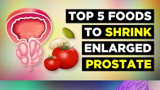 TOP 5 Foods To Shrink Enlarged Prostate