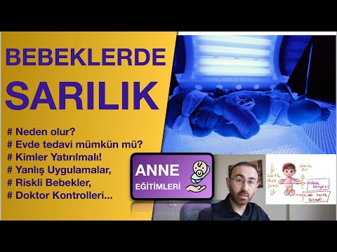 Video: Çıkık Omuz Nasıl Rahatlatılır: 9 Adım