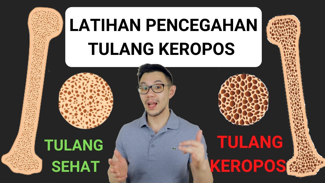 LATIHAN PENCEGAHAN TULANG KEROPOS / OSTEOPOROSIS