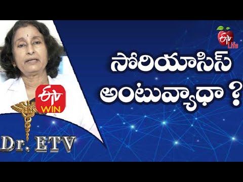 Is Psoriasis Contagious | సోరియాసిస్ అంటువ్యాధా | Dr.ETV | 1st  February 2021  | ETV Life