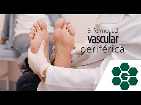 Tratamientos periférica enfermedad arterial