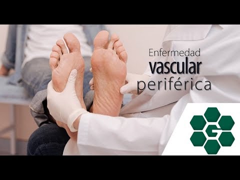 Vídeo: Compromiso Vascular En Enfermedades Reumáticas: 'reumatología Vascular