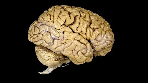 What Can You Do Without a Brain?