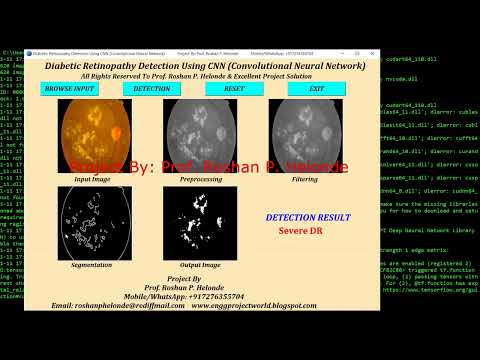 Diabetic Retinopathy Detection Using Python Opencv | Diabetic Retinopathy Prediction