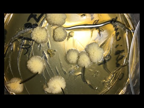 Video: Bakterioza E Hudhrës