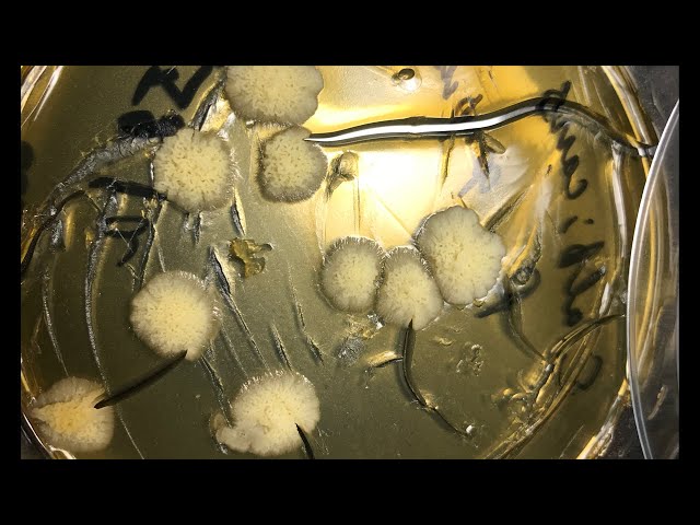 ДНК Candida albicans в мазке у женщин в норме ДНК Candida albicans в мазке у женщин в норме
