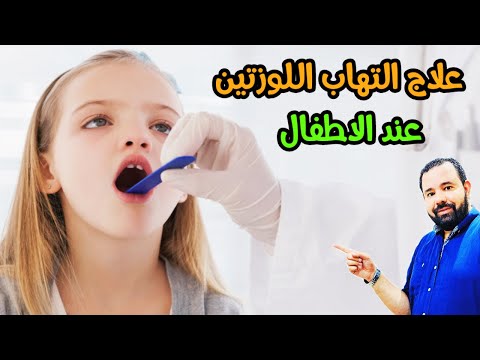 فيديو: كيفية علاج التهاب اللوزتين المزمن عند الأطفال