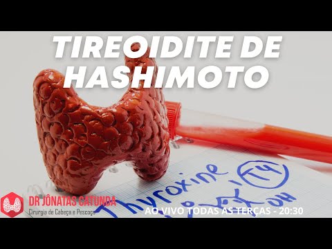 Tireoidite de Hashimoto - o que é, sintomas, tratamento, consequências