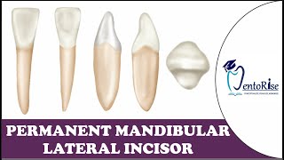 Permanent Mandibular Lateral Incisor Tooth Morphology Dental Anatomy