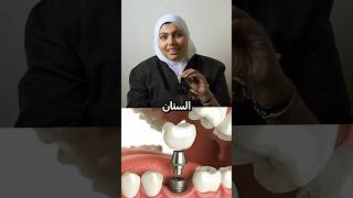 ازاي اثبت طقم الاسنان dentist teethwhitening smile edit dentistry orthodontist bracket