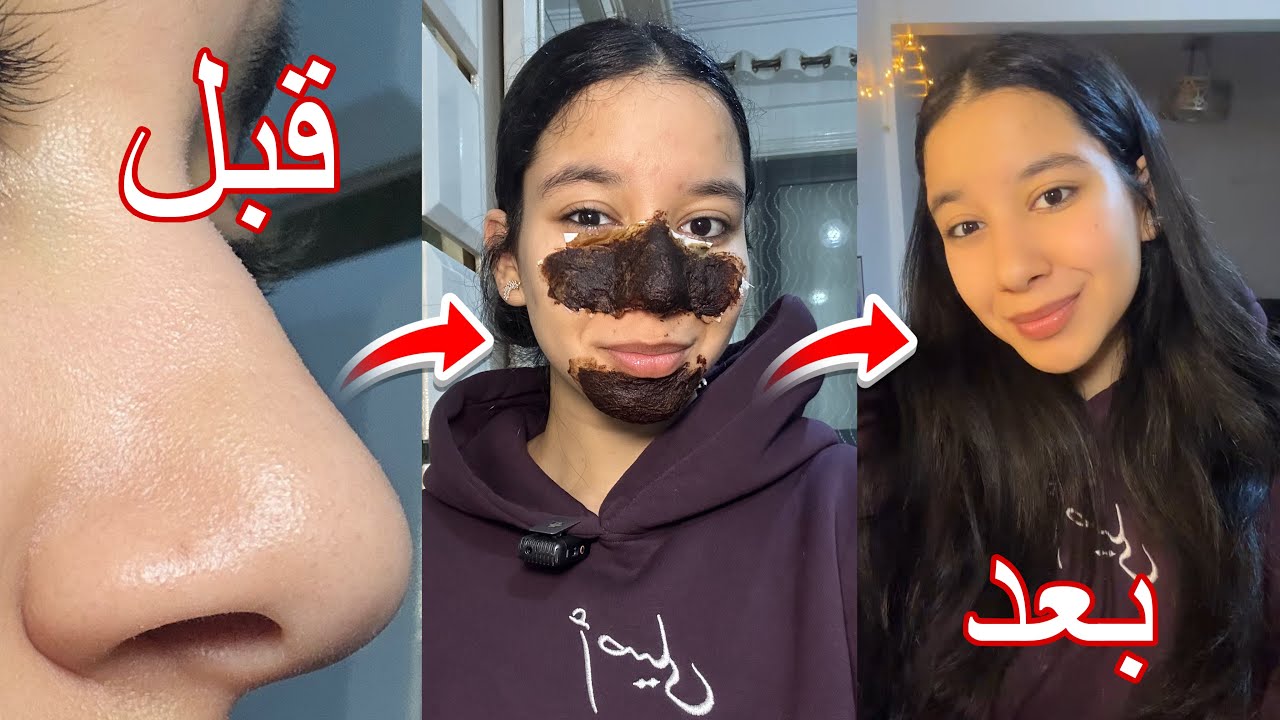 التخلص من الرؤوس السوداء بمكونين فقط في كل بيت🤩🎀من اول مره هتتخلصي من كل الرؤوس🤩 |تجهيزات العيد🎀