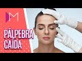 Blefaroplastia: saiba tudo sobre cirurgia nas pálpebras - Mulheres (17/09/18)