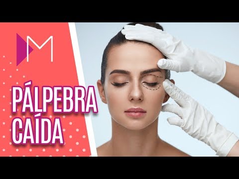 Vídeo: Blefaroplastia: Por Que é Necessária? Opinião Do Cirurgião