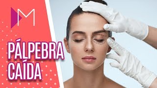 Blefaroplastia: saiba tudo sobre cirurgia nas pálpebras - Mulheres (17/09/18)