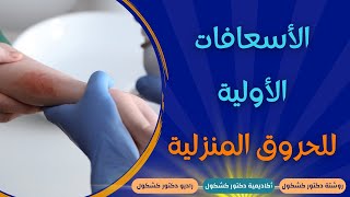 الأسعافات الأولية للحروق المنزلية