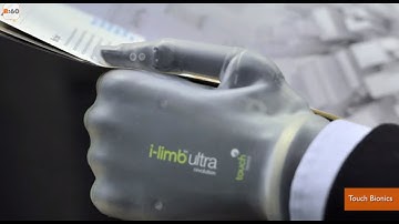 Company Creates Smartphone-Controlled Prosthetic Hand