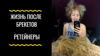 Жизнь после брекетов. Ретеинеры