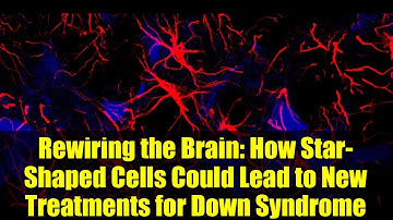 Rewiring the Brain: How Star-Shaped Cells Could Lead to New Treatments for Down Syndrome
