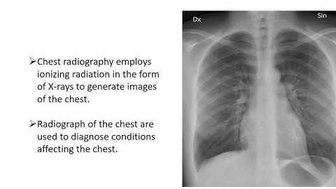 Capstone Project (CSE 400) Group B-3 - [Progress Video] WK 2