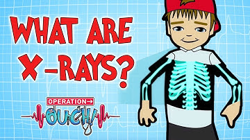 How do X-Rays Work? | Broken Bones | Operation Ouch