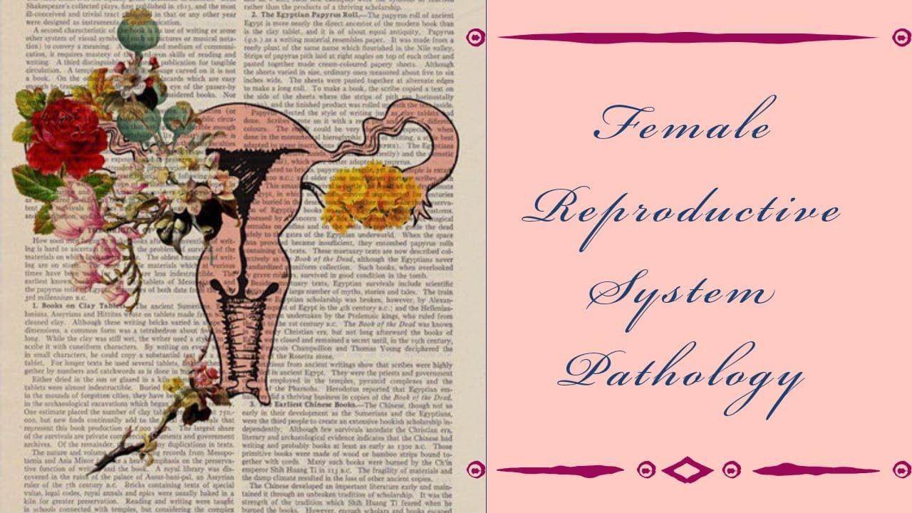 FEMALE REPRODUCTIVE SYSTEM PATHOLOGY lecture 26 GESTATIONAL TROPHOBLASTIC DISEASE, hydatidiform mole
