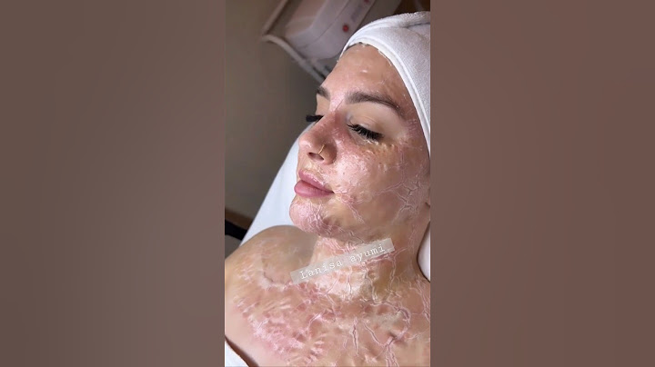 SKINCARE PEELING OMG #video #viral #skincare #asmr #makeup #shortvideo #shorts #shortvideo #peeling