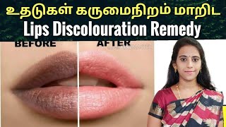 Black Lips to Pink Lips simple home remedy/ Black lip discolouration/ உதடு கருமைநிறம் மாறிட