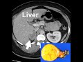 Simplified Medical Coding for Endocrine and Hematological Imaging Procedures