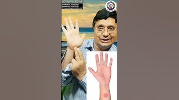 नकारात्मक विचारों और डिप्रेशन को दूर करने का दूर करने का चमत्कारी एक्यूप्रेशर प्वाइंट #shorts #short