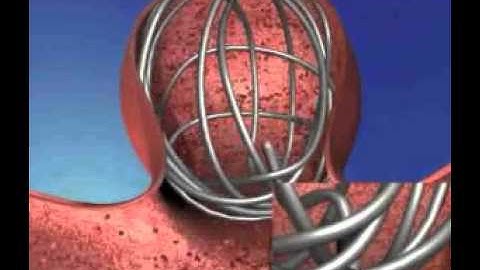 Microvention Coiling System