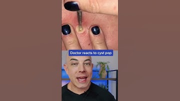 Doctor reacts to big cyst pop! #pimplepop #cystpop #dermreacts