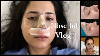 NOSE JOB VLOG IN ISTANBUL, TURKEY | CLINICHUB screenshot 4