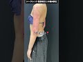 二の腕脂肪吸引の完成までの経過です