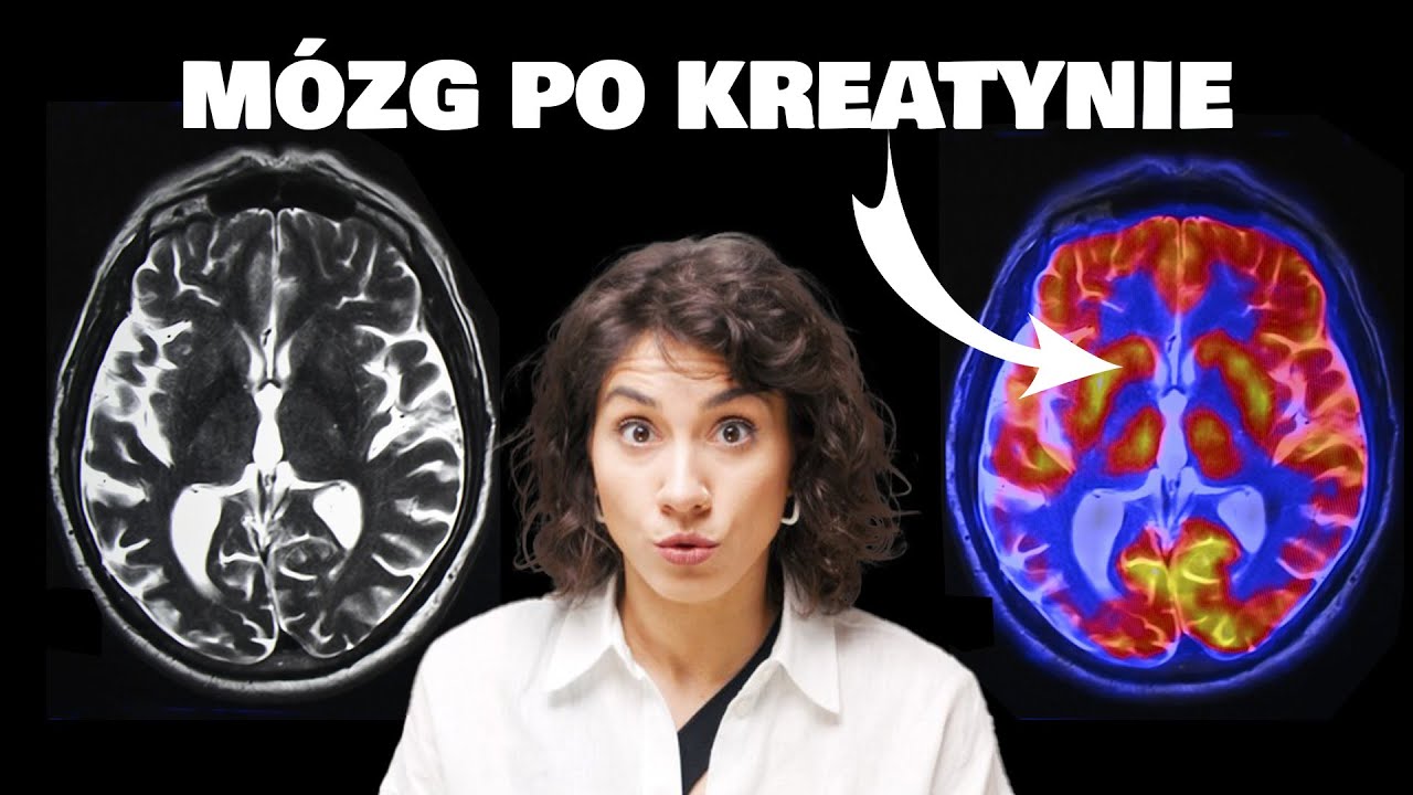 Kreatyna - jak wpływa na twój mózg?