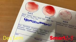 የደም አይነታችንን በቤታችን ማወቅ እንችላለን...How to know your blood type at home,  without going to a doctor. screenshot 2