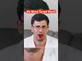 My Blood Turned Black After This… #shorts #funny #entertainment thumbnail