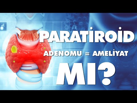 Paratiroid Adenomu = Ameliyat mı?