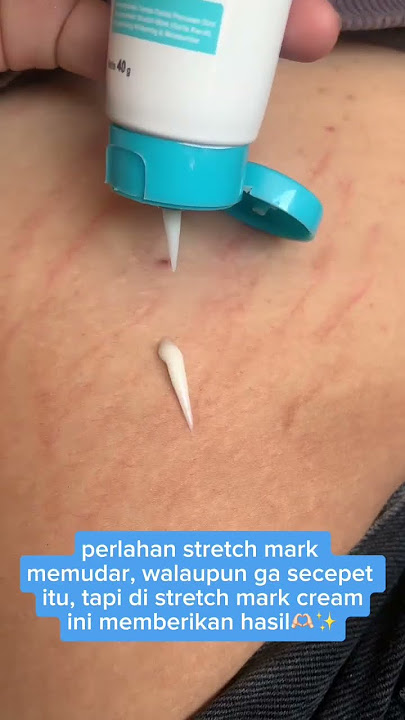 Riview Stretch Mark Cream Aleya