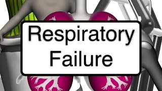 Nursing 101: Respiratory Failure