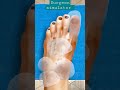 surgeon simulator madical treatment foot ytshorts surgeon simulator madical treatment foot ytshorts