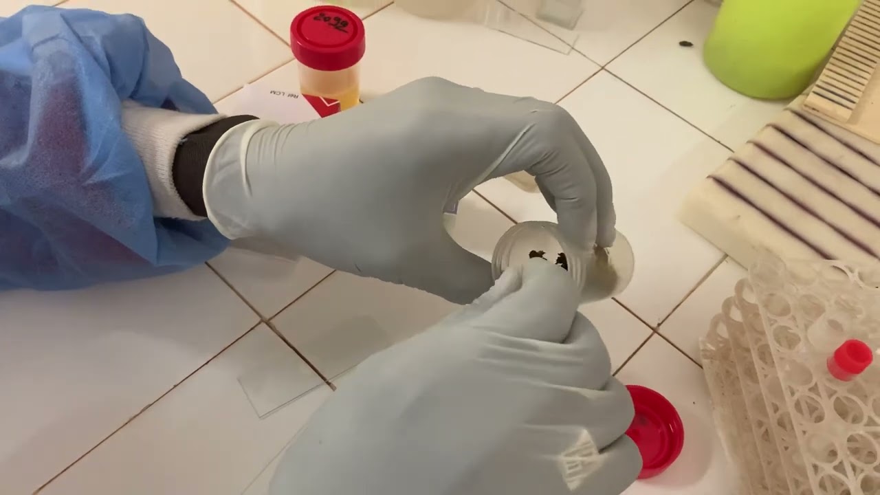 EXAMEN PARASITOLOGIQUE DES SELLES ÉTAT FRAIS