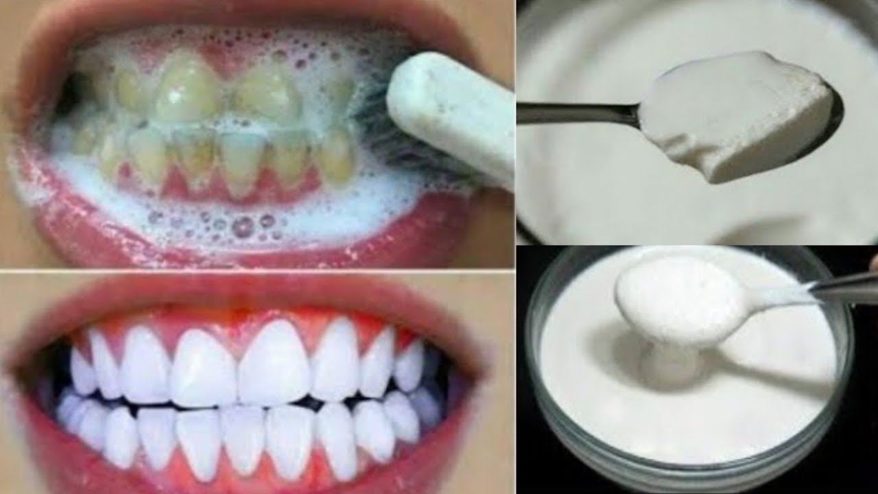 In 2 Minutes, Whiten Yellow Teeth at home, Teeth Scaling, Shiny Snow White Teeth Naturally at