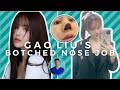 GAO LIU'S BOTCHED NOSE JOB: Tip Necrosis from Open Rhinoplasty