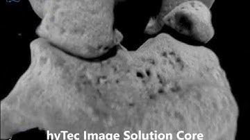 MicroCT Image: Bone (Tibia and Femur) -- hyTec Image Solution Core