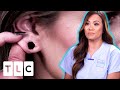 Dr. Lee Reconstructs A Young Woman's Over-Stretched Ears | Dr. Pimple Popper