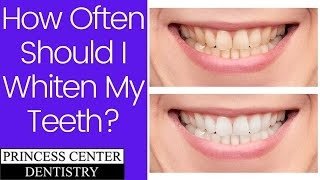 How Often Should I Whiten my Teeth? Details