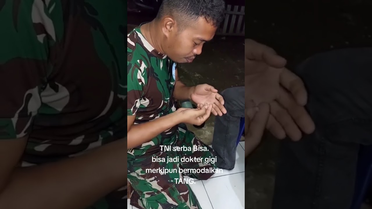TNI Cabut Gigi Pakai tang